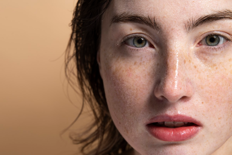 Common Mistakes on Combination Skin - And How I See Them in My Practice