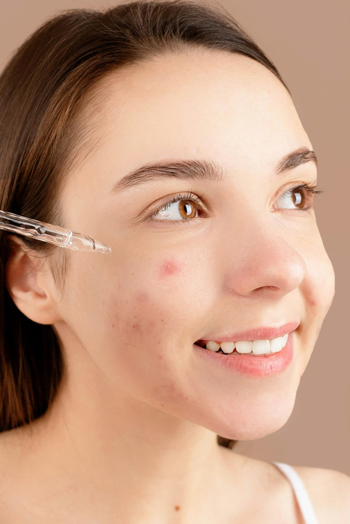 Best 12 Dr. Dennis Gross Products for Acne: Ultimate Guide 2026