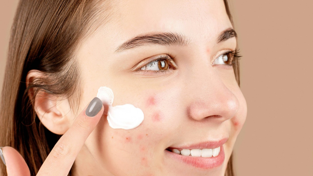 Is Retinol or Retinoid Better for Acne? A Complete Expert Guide