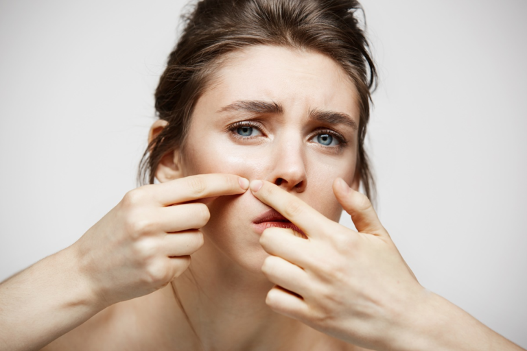 Ingredients to Avoid for Acne-Prone Skin: The Complete Guide to Clearer Skin