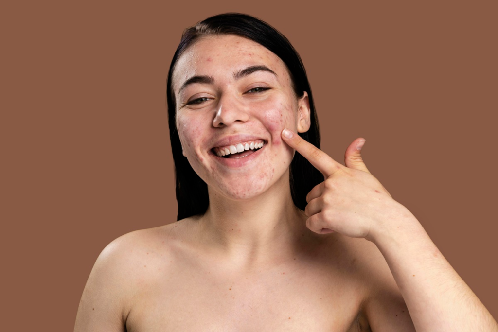Best Esthetician-Approved Nighttime Routine for Fungal Acne